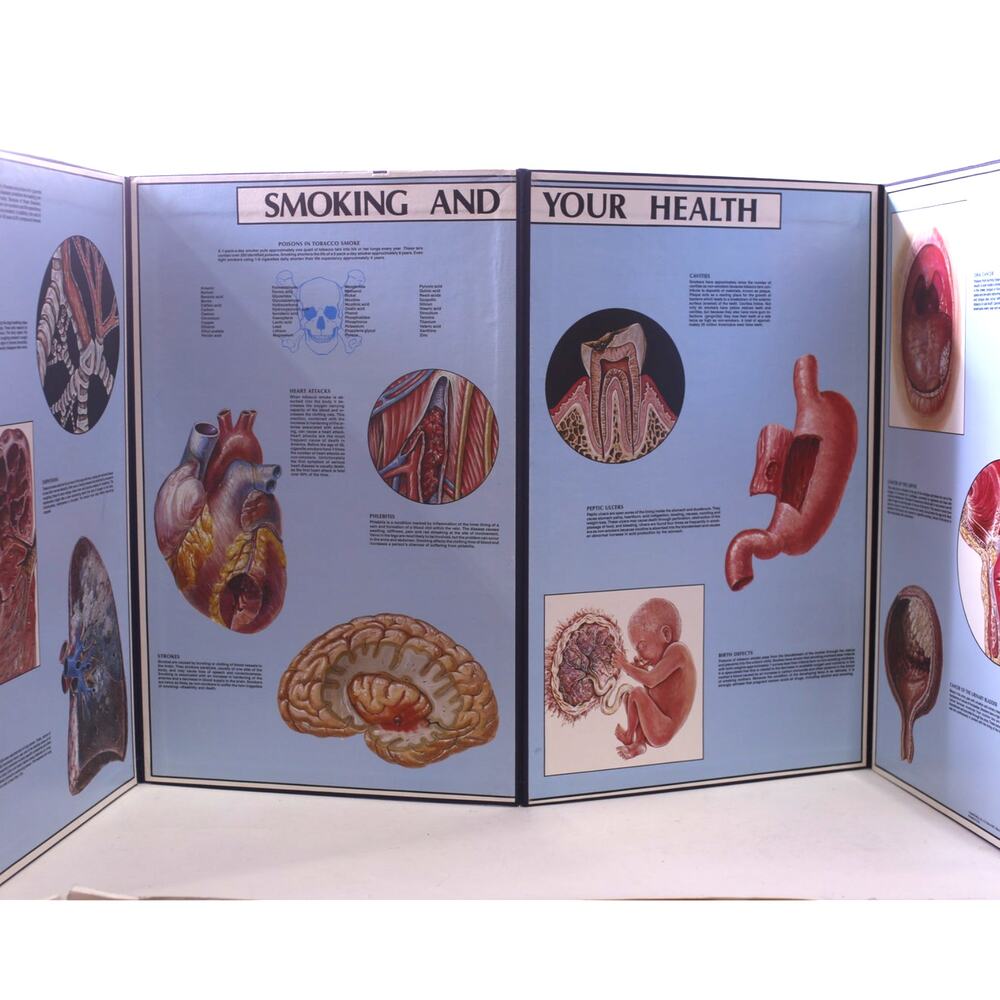 Smoking, Lung Cancer, Vintage, Educational, Classroom, Large Display Wall Hangin